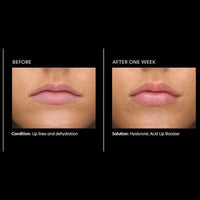 Thumbnail for PCA Skin Hyaluronic Acid Lip Booster 6g